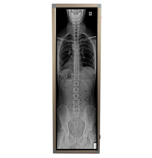 LED Spine - Long Leg Viewbox