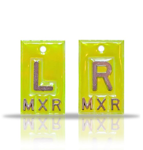 Non Adhesive Vinyl X Ray Markers,Fluorescent Yellow.Wafer Thin: 0.095 in