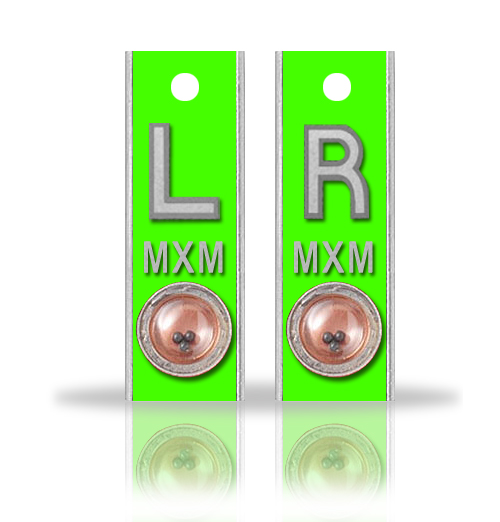 Aluminum Position Indicator X Ray Markers, Yellow Green